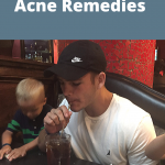 Frugal Home Acne Remedies