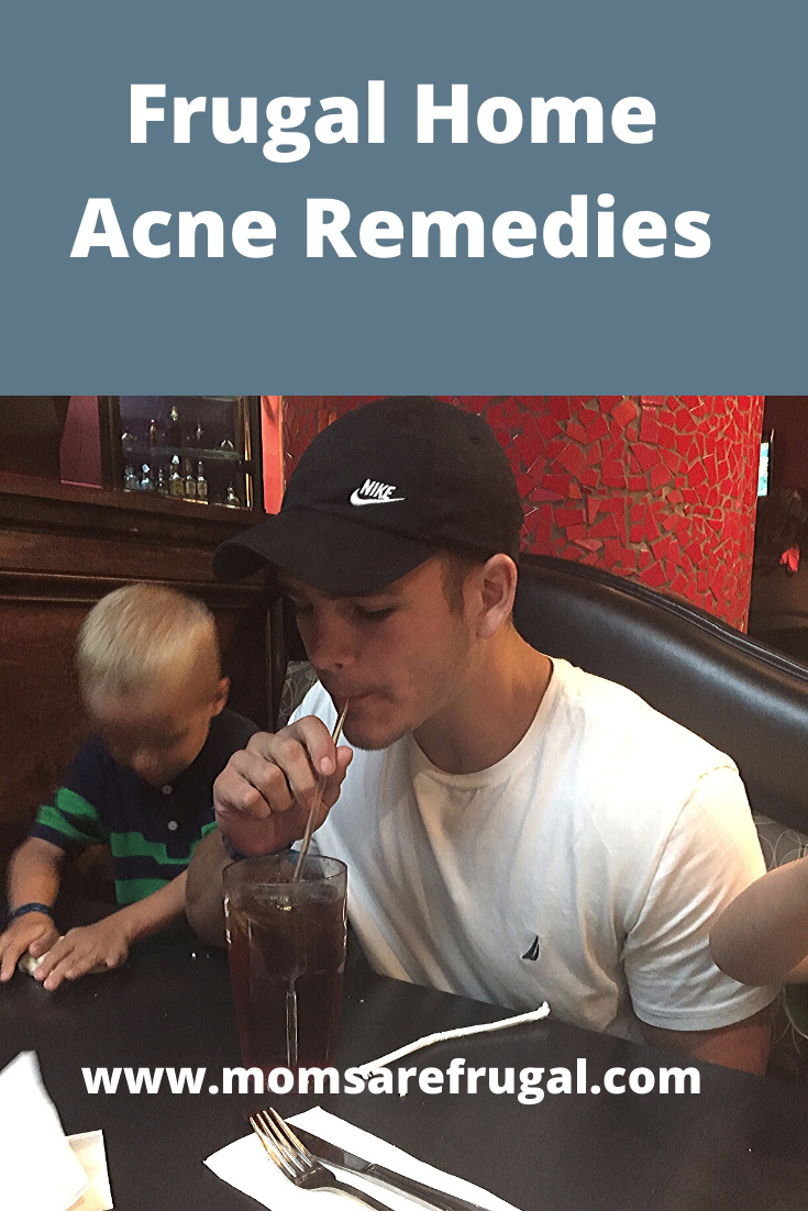 Frugal Home Acne Remedies